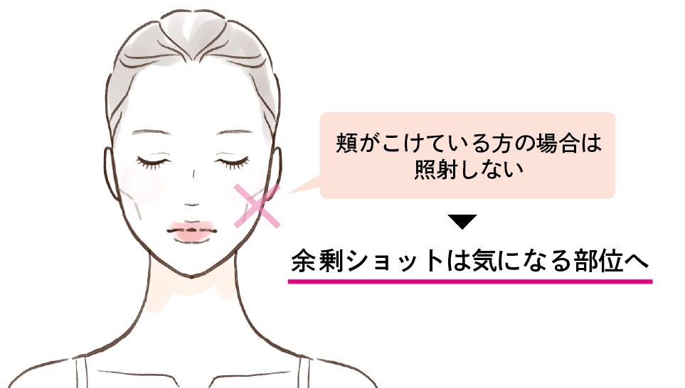 コケには照射しない