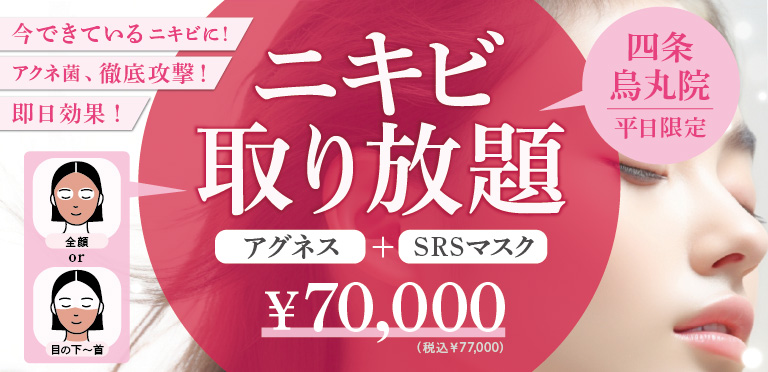 キャンペーンバナー画像