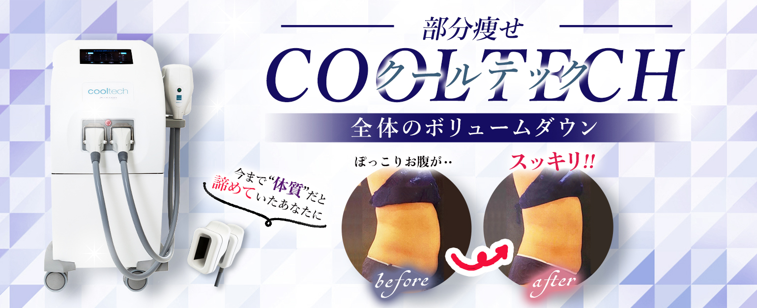 キャンペーンバナー画像