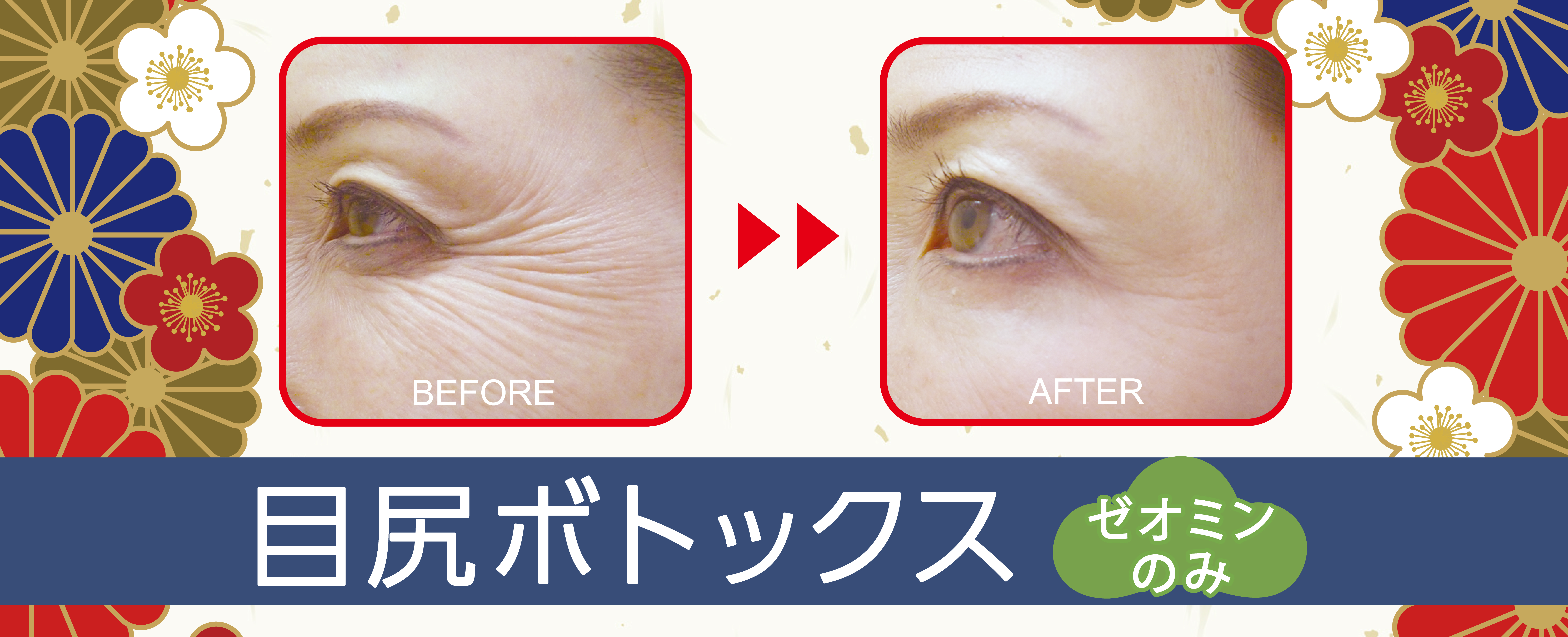 キャンペーンバナー画像